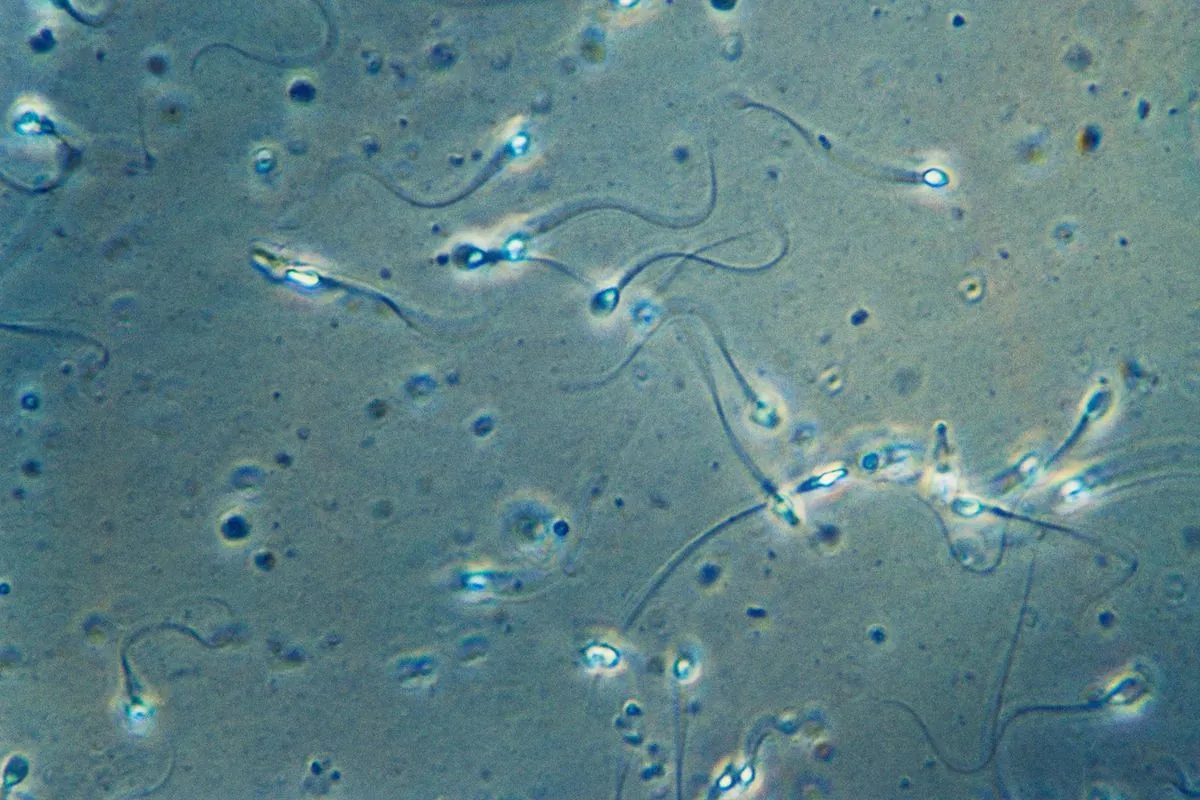 les-spermatozoides--des-athletes-microscopiques-en-perpetuelle-competition