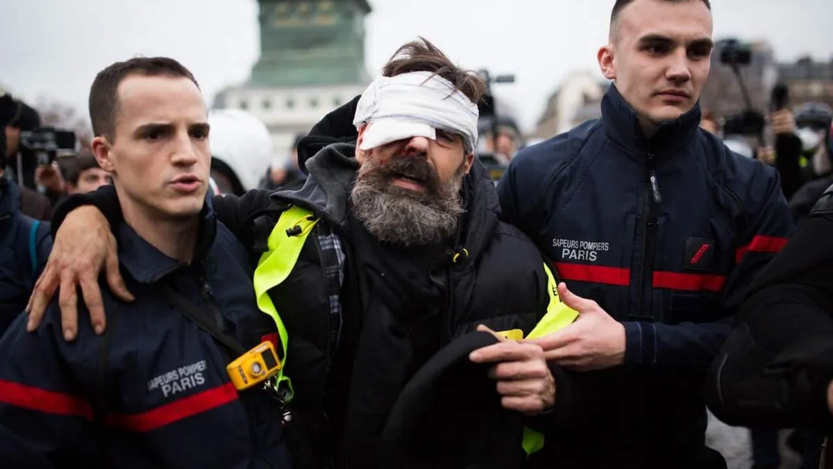 Possible procès d'un policier pour l'éborgnement d'un "gilet jaune"