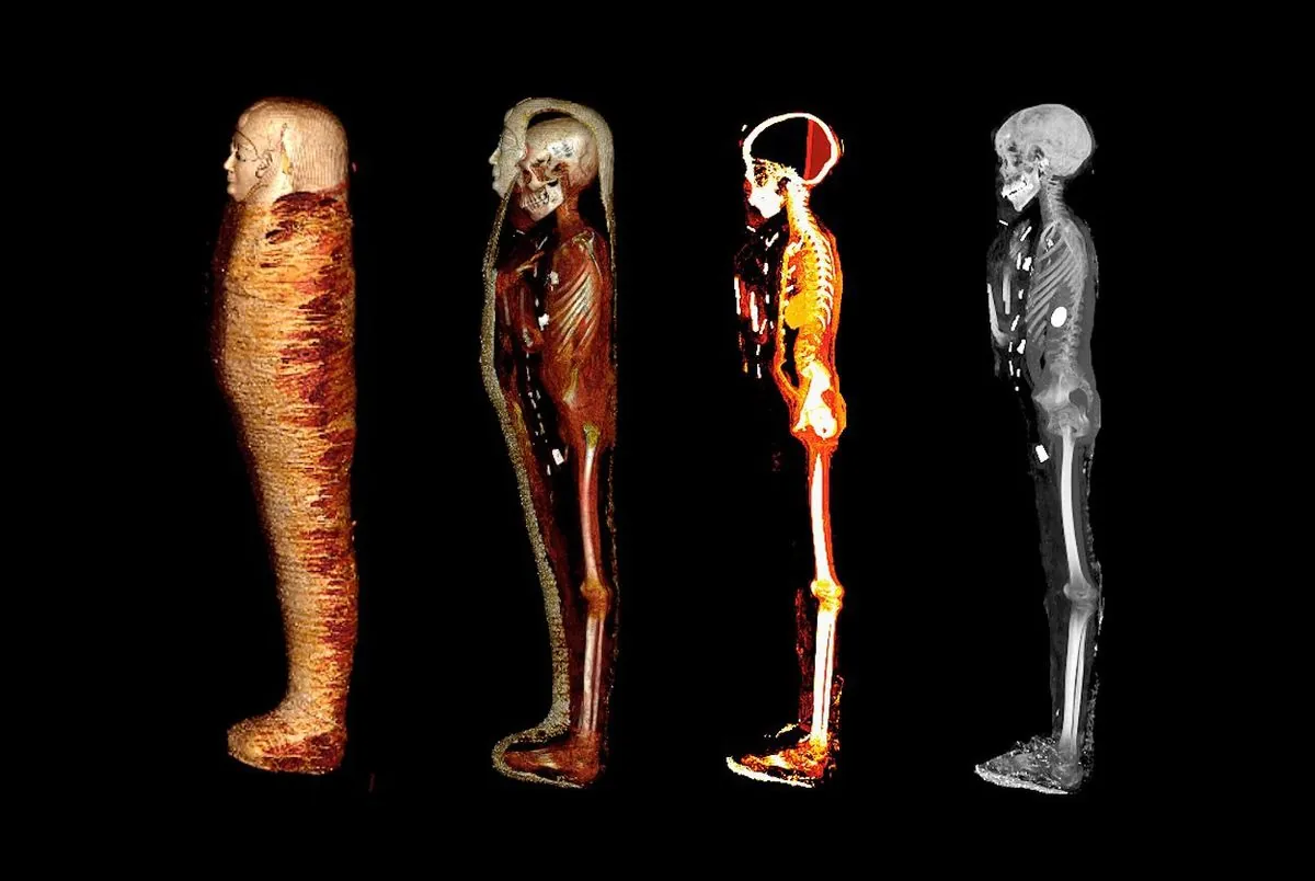 Une momie égyptienne de 3000 ans passe au scanner à Lens